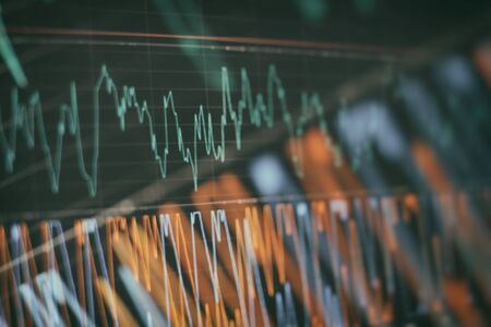 How Confirmation Bias Affects Market Analysis and Stock Picking